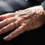 44 million people are thought to be living with dementia worldwide, new figures suggest