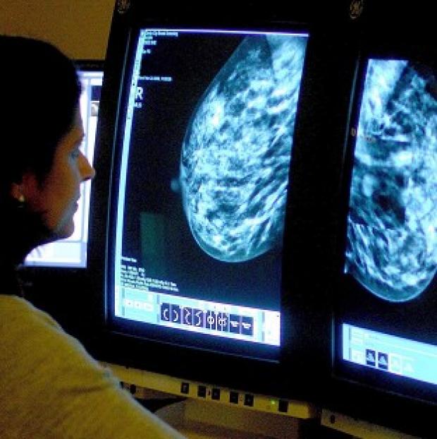 Congleton Guardian: A combination of two drugs helps keep some women with breast cancer free of the disease, say researchers. Congleton Guardian: A combination of two drugs helps keep some women with breast cancer free of the disease, say researchers.