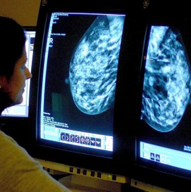 Congleton Guardian: Breast cancer drug anastrozole should be freely available as a preventative treatment, experts urged
Congleton Guardian: Breast cancer drug anastrozole should be freely available as a preventative treatment, experts urged