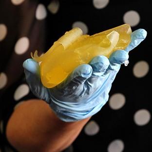 Congleton Guardian: One of the ruptured PIP implants. Congleton Guardian: One of the ruptured PIP implants.