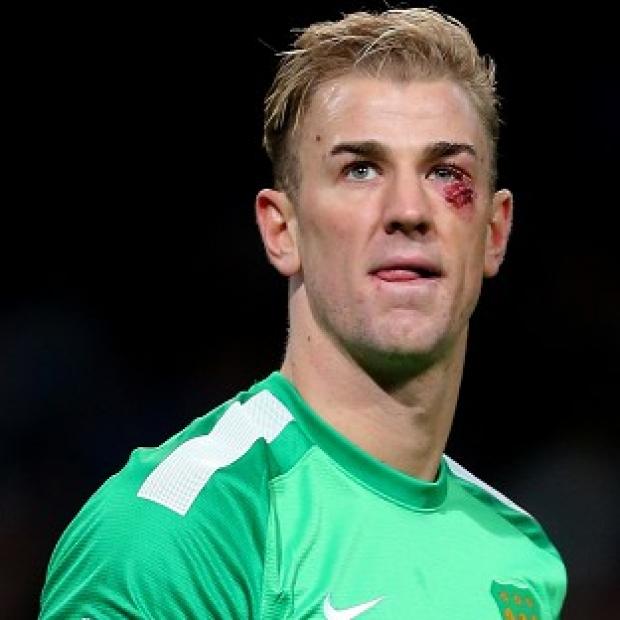 Congleton Guardian: Joe Hart was in good form against Crystal Palace Congleton Guardian: Joe Hart was in good form against Crystal Palace