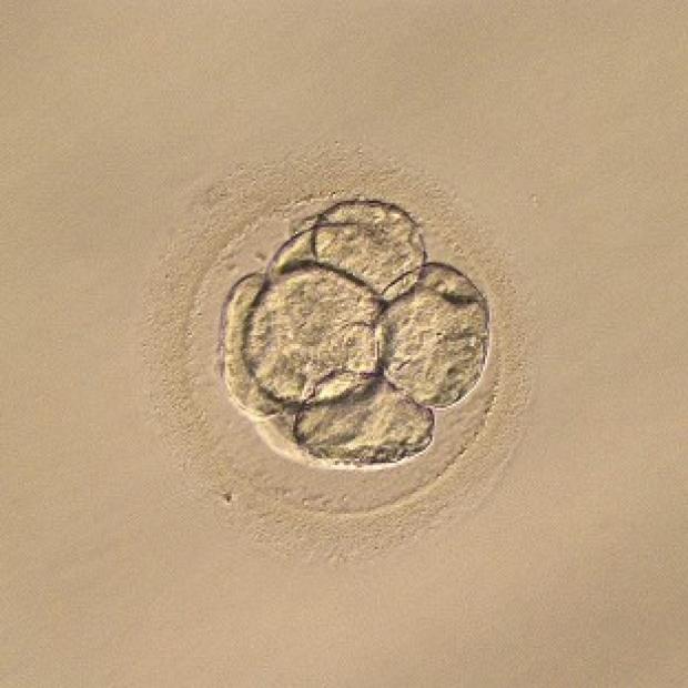 Congleton Guardian: The outcomes of babies conceived with IVF techniques have been detailed in a new study. Congleton Guardian: The outcomes of babies conceived with IVF techniques have been detailed in a new study.