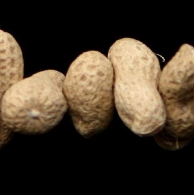 Congleton Guardian: Therapy can help children with allergies to tolerate peanuts Congleton Guardian: Therapy can help children with allergies to tolerate peanuts