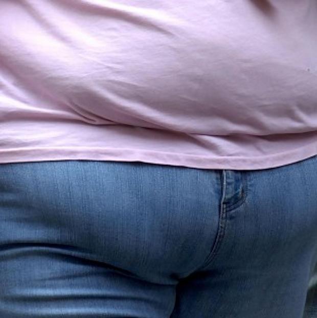 Congleton Guardian: Across all ages, obesity admissions across England last year were lower for every age group except the under-16s and those aged 65 and over. Congleton Guardian: Across all ages, obesity admissions across England last year were lower for every age group except the under-16s and those aged 65 and over.