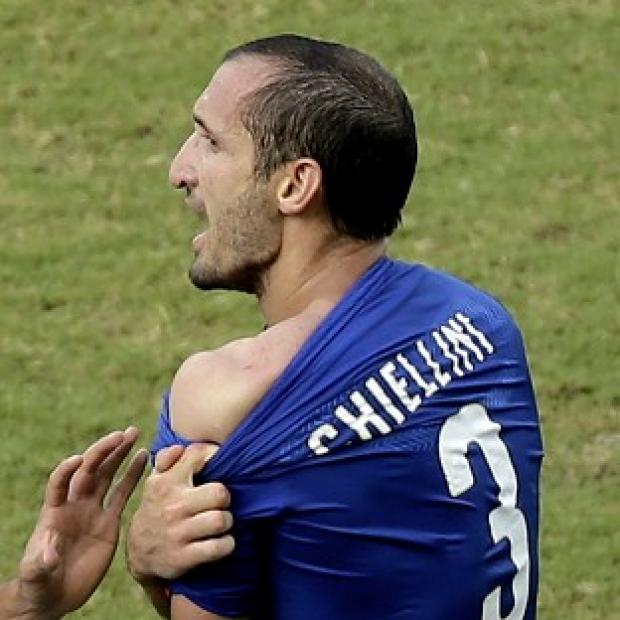 Congleton Guardian: Giorgio Chiellini claims he was bitten by Luis Suarez (AP) Congleton Guardian: Giorgio Chiellini claims he was bitten by Luis Suarez (AP)